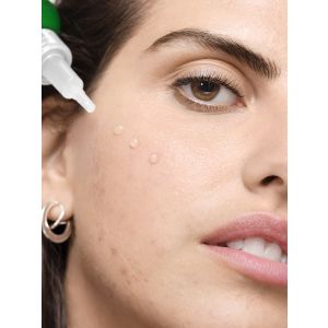 Vichy Normaderm Probio-BHA -seerumi 30 ml